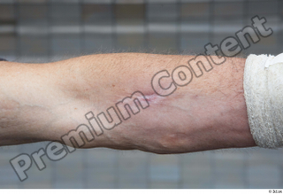 Street  661 forearm 0002.jpg